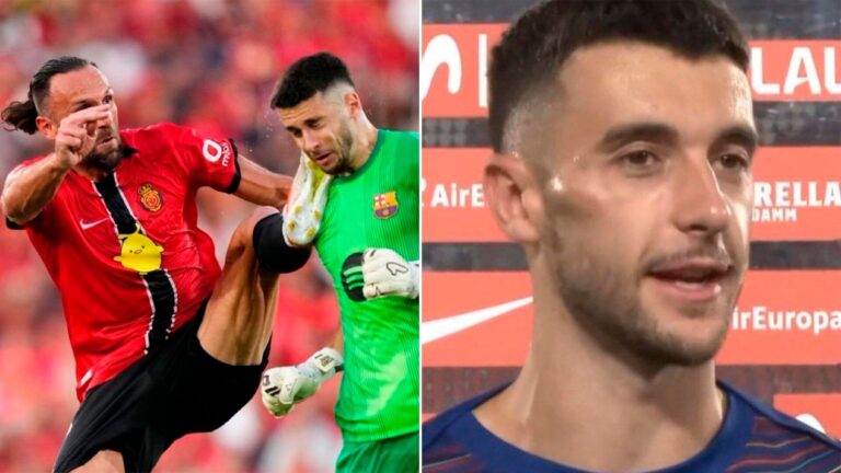 La impactante patada que sufrió el nuevo arquero del Barcelona en su debut: la marca en el rostro y su reacción tras el partido